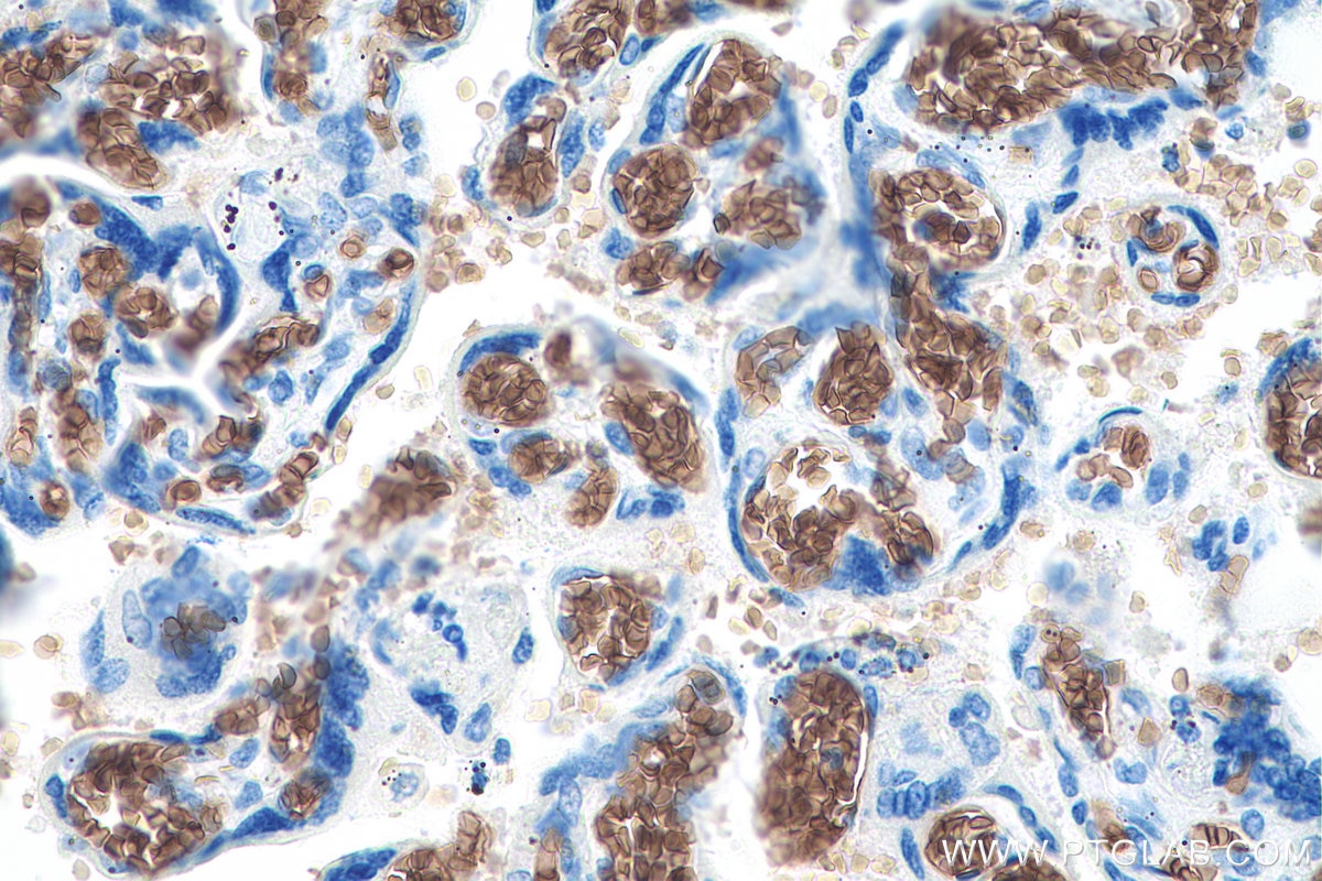 Immunohistochemistry (IHC) staining of human placenta tissue using ICAM4 Monoclonal antibody (67014-1-Ig)