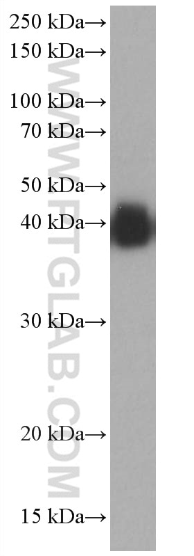 Western Blot (WB) analysis of human red blood cells using ICAM4 Monoclonal antibody (67014-1-Ig)