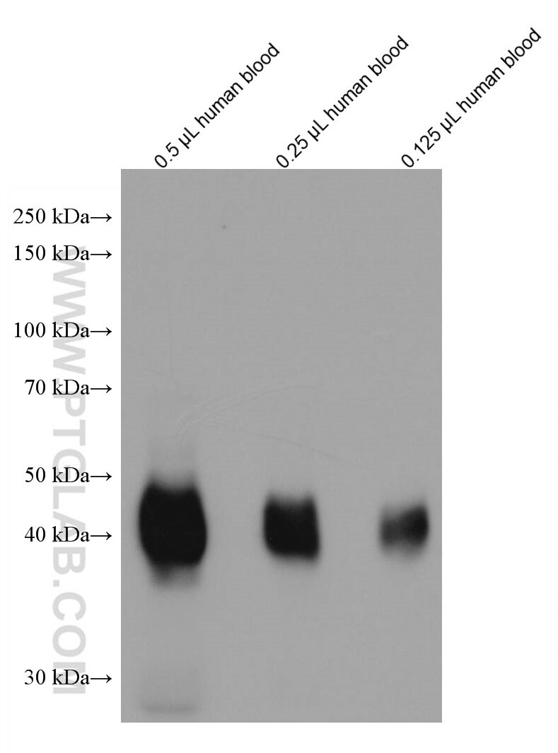 Western Blot (WB) analysis of various lysates using ICAM4 Monoclonal antibody (67014-1-Ig)