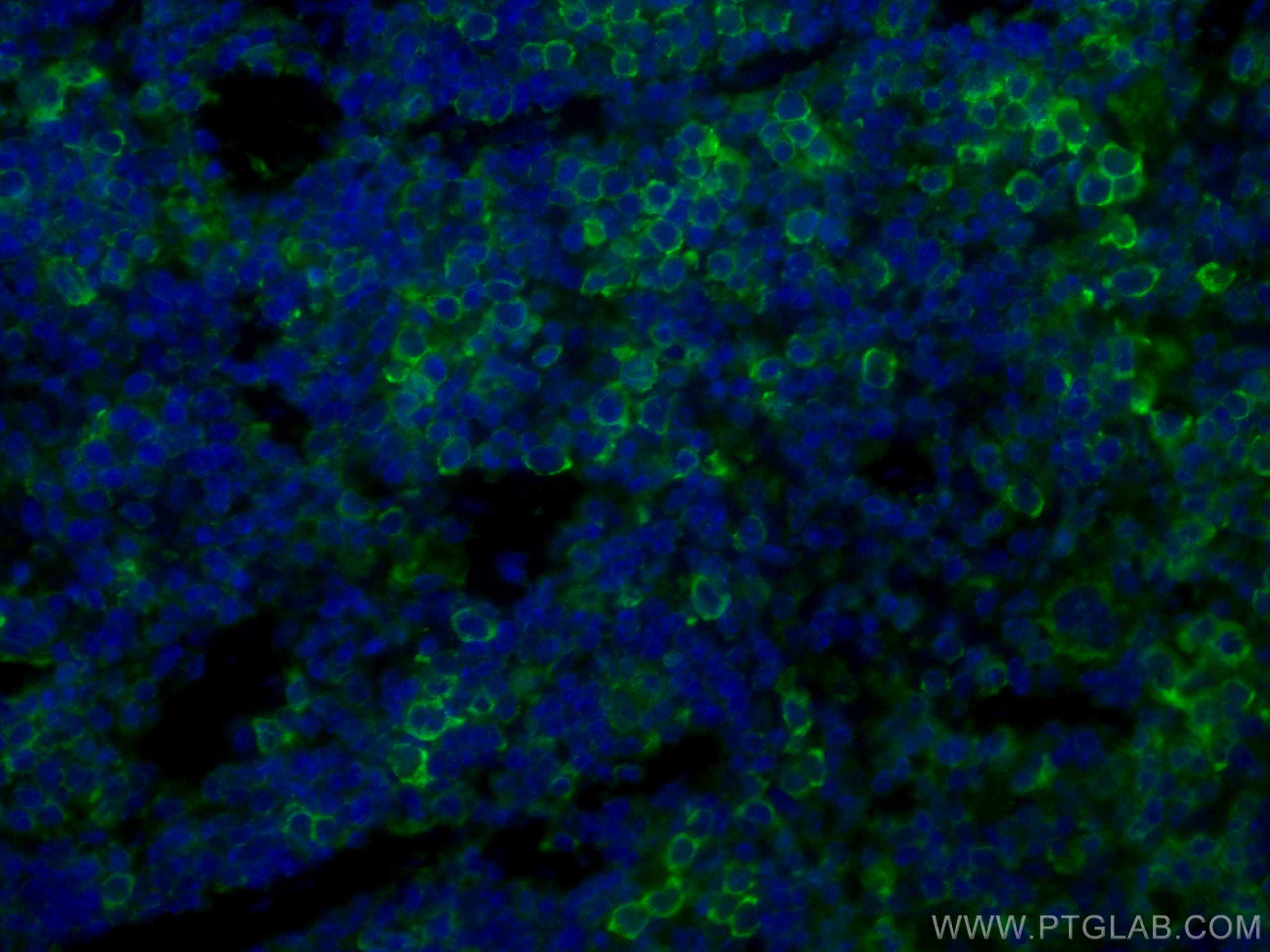Immunofluorescence (IF) / fluorescent staining of human spleen tissue using CoraLite® Plus 488-conjugated ICAM4 Monoclonal ant (CL488-67014)