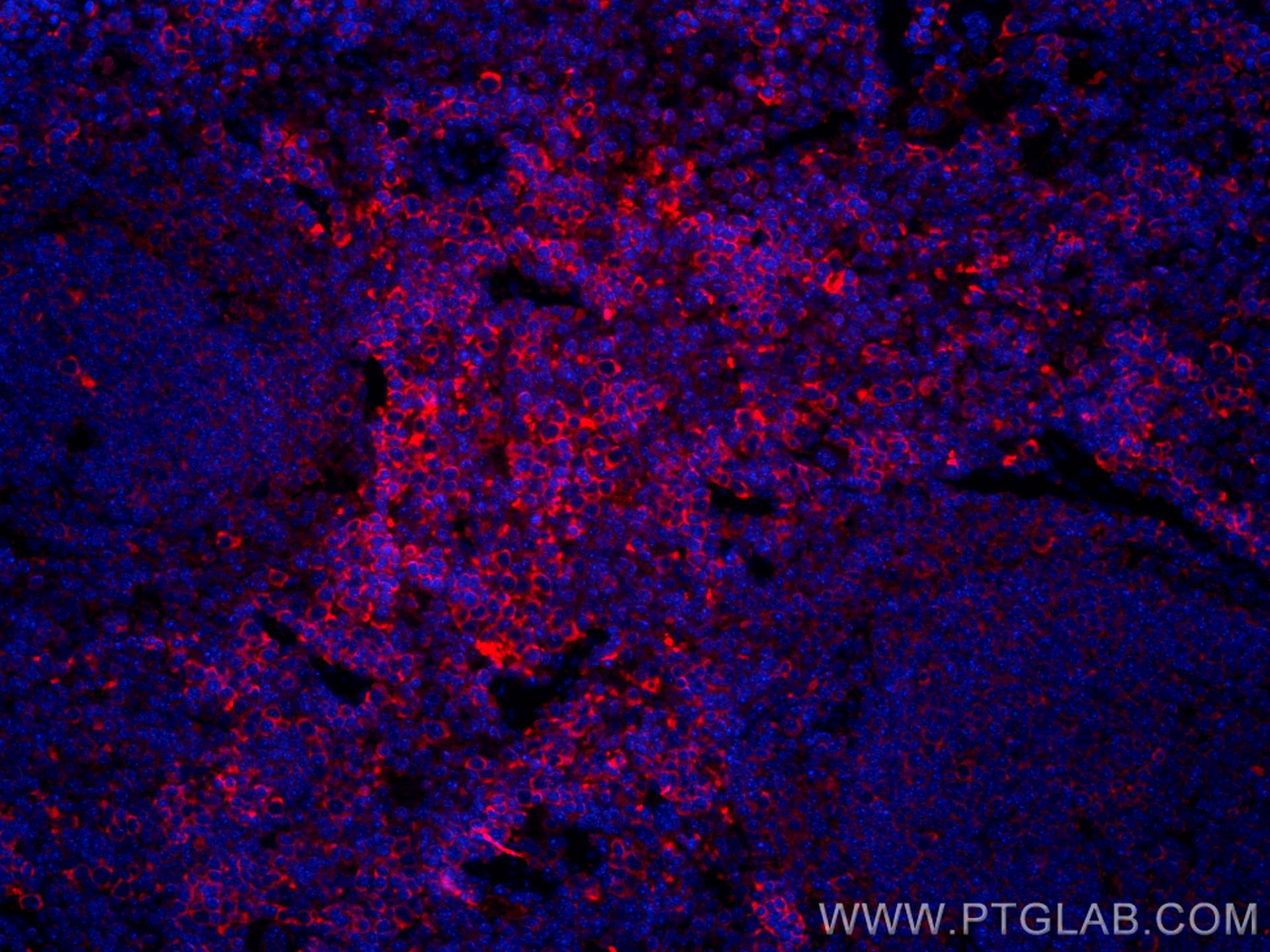 IF Staining of mouse spleen using CL594-67014