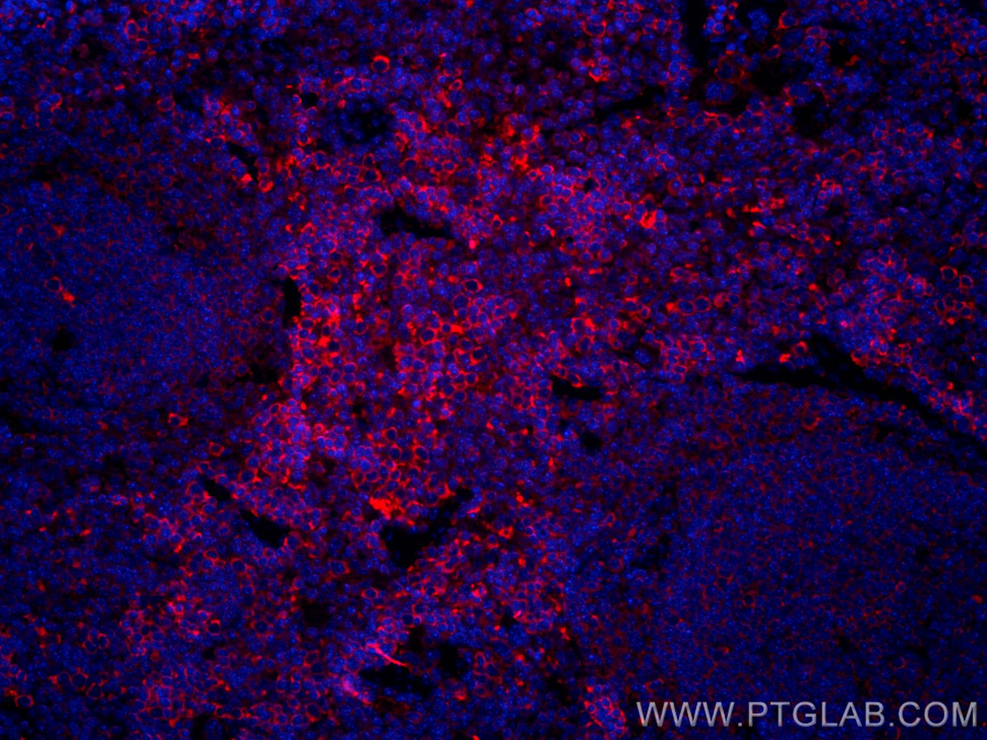 Immunofluorescence (IF) / fluorescent staining of mouse spleen tissue using CoraLite®594-conjugated ICAM4 Monoclonal antibody (CL594-67014)