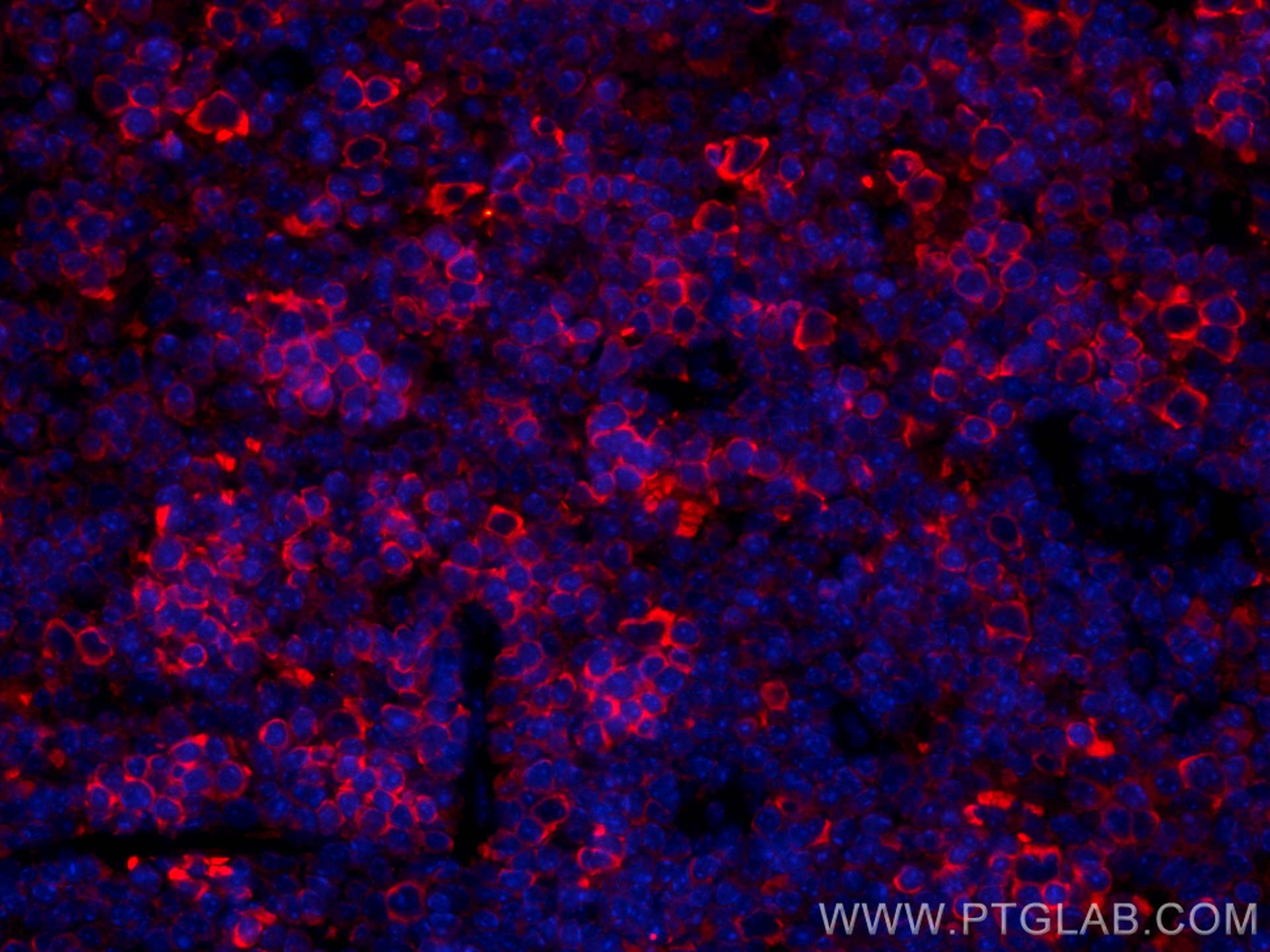 Immunofluorescence (IF) / fluorescent staining of mouse spleen tissue using CoraLite®594-conjugated ICAM4 Monoclonal antibody (CL594-67014)