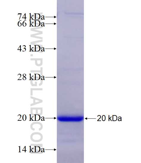 ICAM4 fusion protein Ag27628 SDS-PAGE
