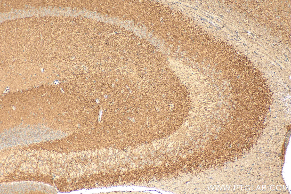 IHC staining of mouse brain using 12759-1-AP (same clone as 12759-1-PBS) Immunohistochemistry (IHC) staining of mouse brain tissue using ICAM5 Polyclonal antibody (12759-1-AP)