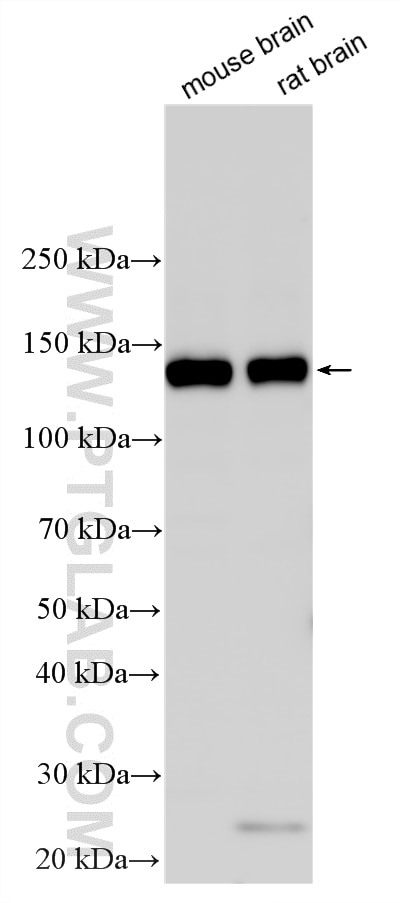 WB analysis using 12759-1-AP (same clone as 12759-1-PBS) Western Blot (WB) analysis of various lysates using ICAM5 Polyclonal antibody (12759-1-AP)