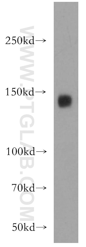 Western Blot (WB) analysis of mouse brain tissue using ICAM5 Polyclonal antibody (12759-1-AP)