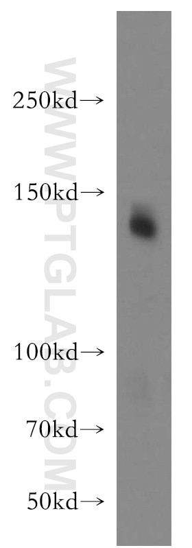 Western Blot (WB) analysis of mouse brain tissue using ICAM5 Polyclonal antibody (12759-1-AP)