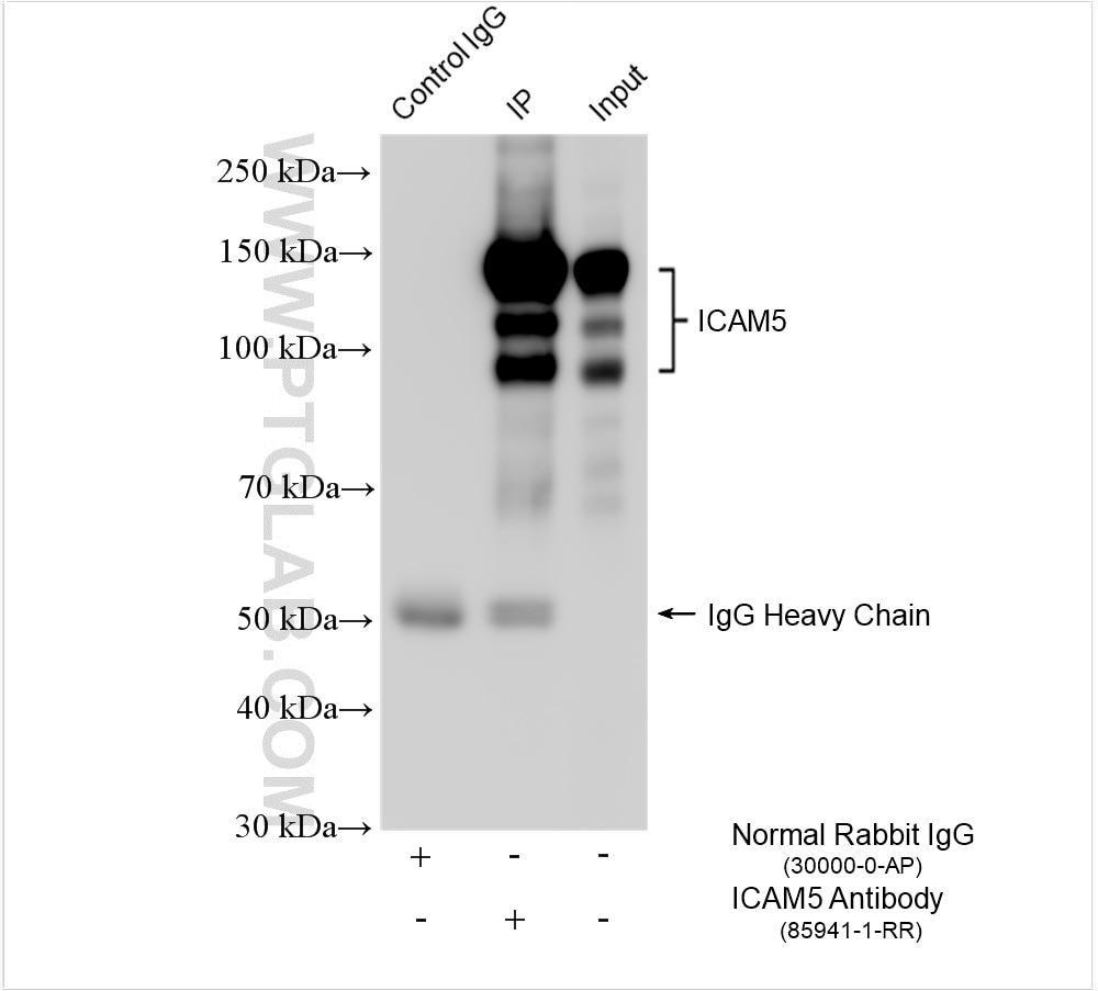 Immunoprecipitation (IP) experiment of mouse brain tissue using ICAM5 Recombinant antibody (85941-1-RR)