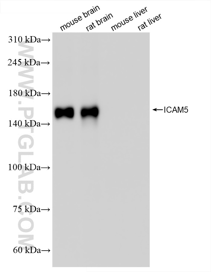 Western Blot (WB) analysis of various lysates using ICAM5 Recombinant antibody (85941-1-RR)