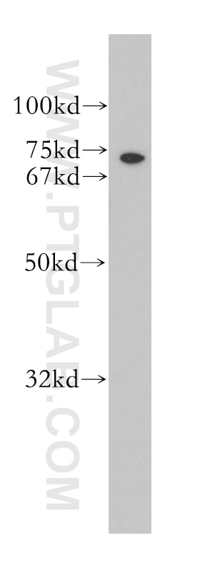 Western Blot (WB) analysis of PC-3 cells using ICK Polyclonal antibody (13611-1-AP)