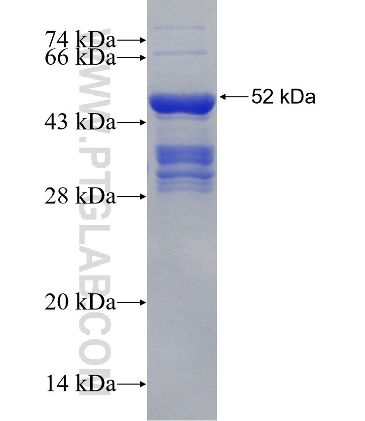 ICK fusion protein Ag30240 SDS-PAGE