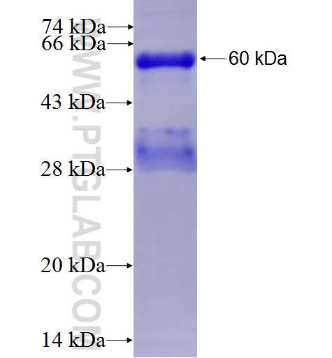 ICK fusion protein Ag4511 SDS-PAGE
