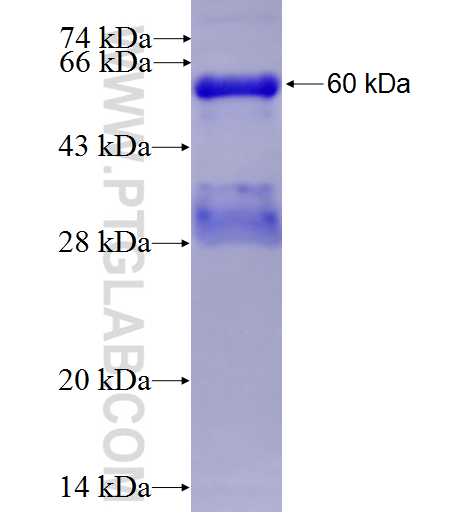 ICK fusion protein Ag4511 SDS-PAGE