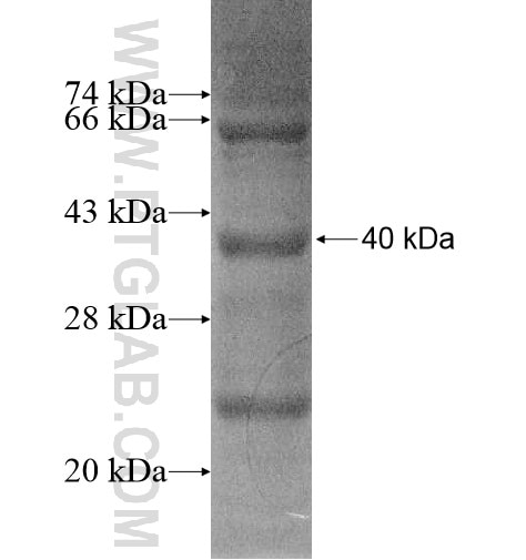 ICMT fusion protein Ag14668 SDS-PAGE