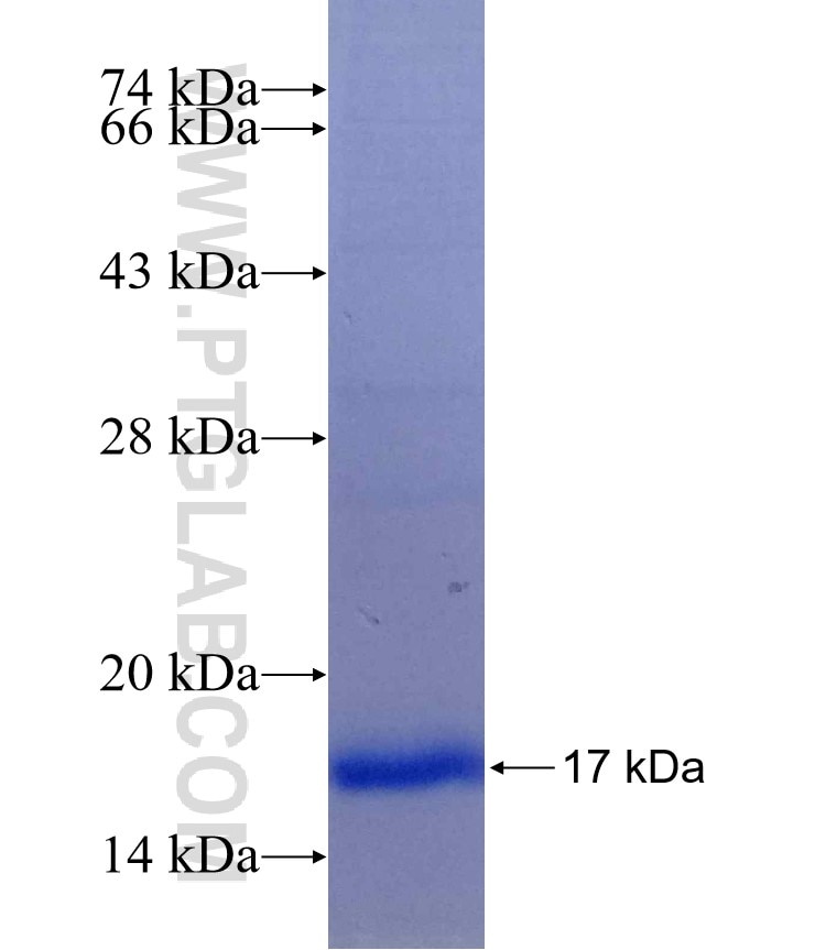 ICMT fusion protein Ag14981 SDS-PAGE