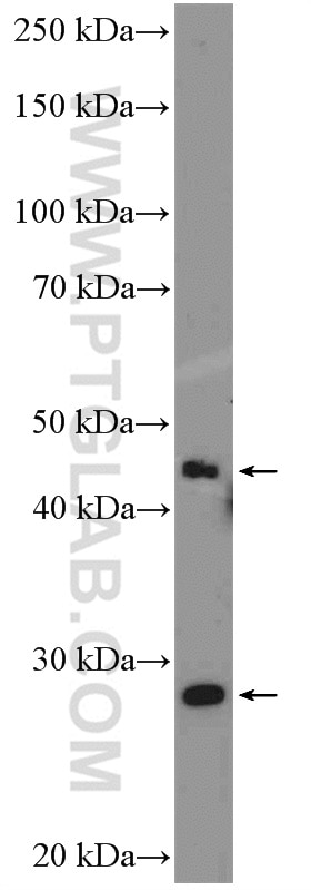 Western Blot (WB) analysis of HL-60 cells using ICOS Polyclonal antibody (13338-1-AP)