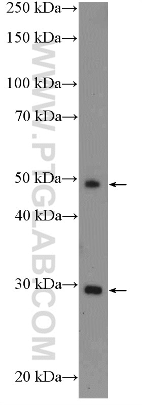 Western Blot (WB) analysis of Jurkat cells using ICOS Polyclonal antibody (13338-1-AP)