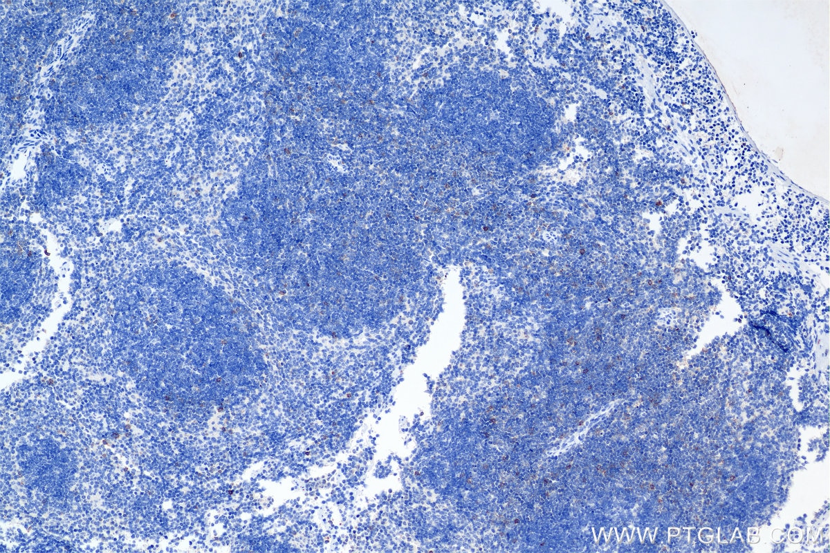 Immunohistochemical analysis of paraffin-embedded mouse spleen tissue slide using 85035-2-RR (ICOS/CD278 antibody) at dilution of 1:1000 (under 10x lens). Heat mediated antigen retrieval with Tris-EDTA buffer (pH 9.0). This data was developed using the same antibody clone with 85035-2-PBS in a different storage buffer formulation. Immunohistochemistry (IHC) staining of mouse spleen tissue using ICOS/CD278 Recombinant monoclonal antibody (85035-2-RR)