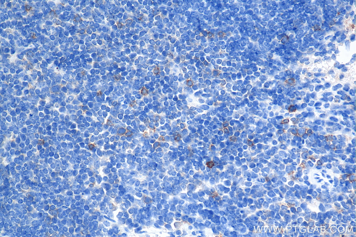 Immunohistochemical analysis of paraffin-embedded mouse spleen tissue slide using 85035-2-RR (ICOS/CD278 antibody) at dilution of 1:1000 (under 40x lens). Heat mediated antigen retrieval with Tris-EDTA buffer (pH 9.0). This data was developed using the same antibody clone with 85035-2-PBS in a different storage buffer formulation. Immunohistochemistry (IHC) staining of mouse spleen tissue using ICOS/CD278 Recombinant monoclonal antibody (85035-2-RR)
