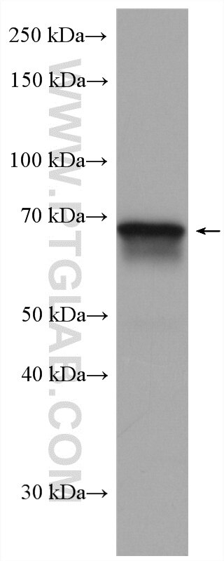 Western Blot (WB) analysis of JAR cells using ICOSLG Polyclonal antibody (14922-1-AP)