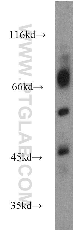 Western Blot (WB) analysis of Jurkat cells using ICOSLG Polyclonal antibody (14922-1-AP)