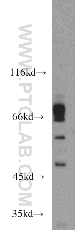 Western Blot (WB) analysis of Jurkat cells using ICOSLG Polyclonal antibody (14922-1-AP)