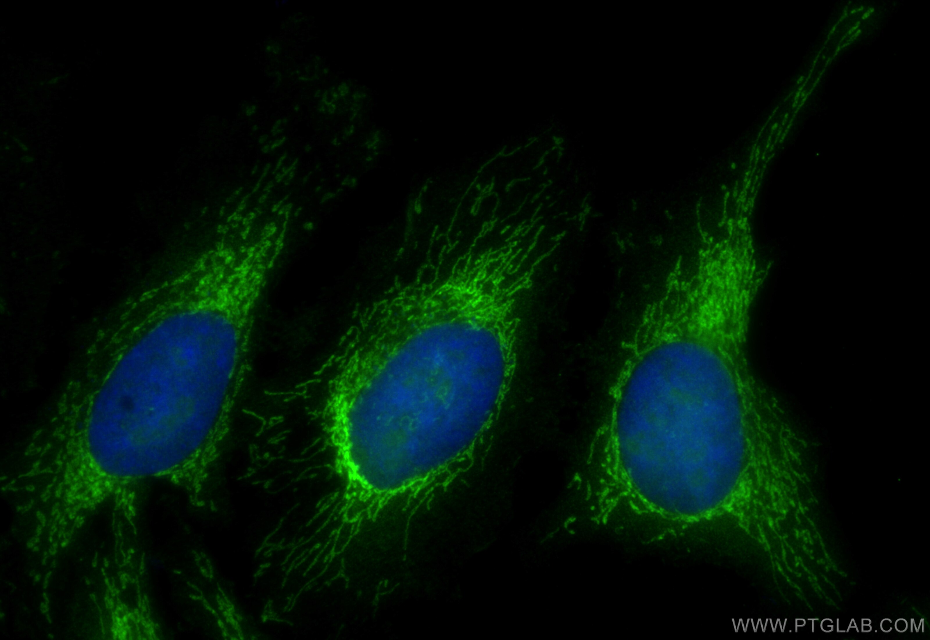 Immunofluorescence (IF) / fluorescent staining of HeLa cells using ICT1 Polyclonal antibody (10403-1-AP)