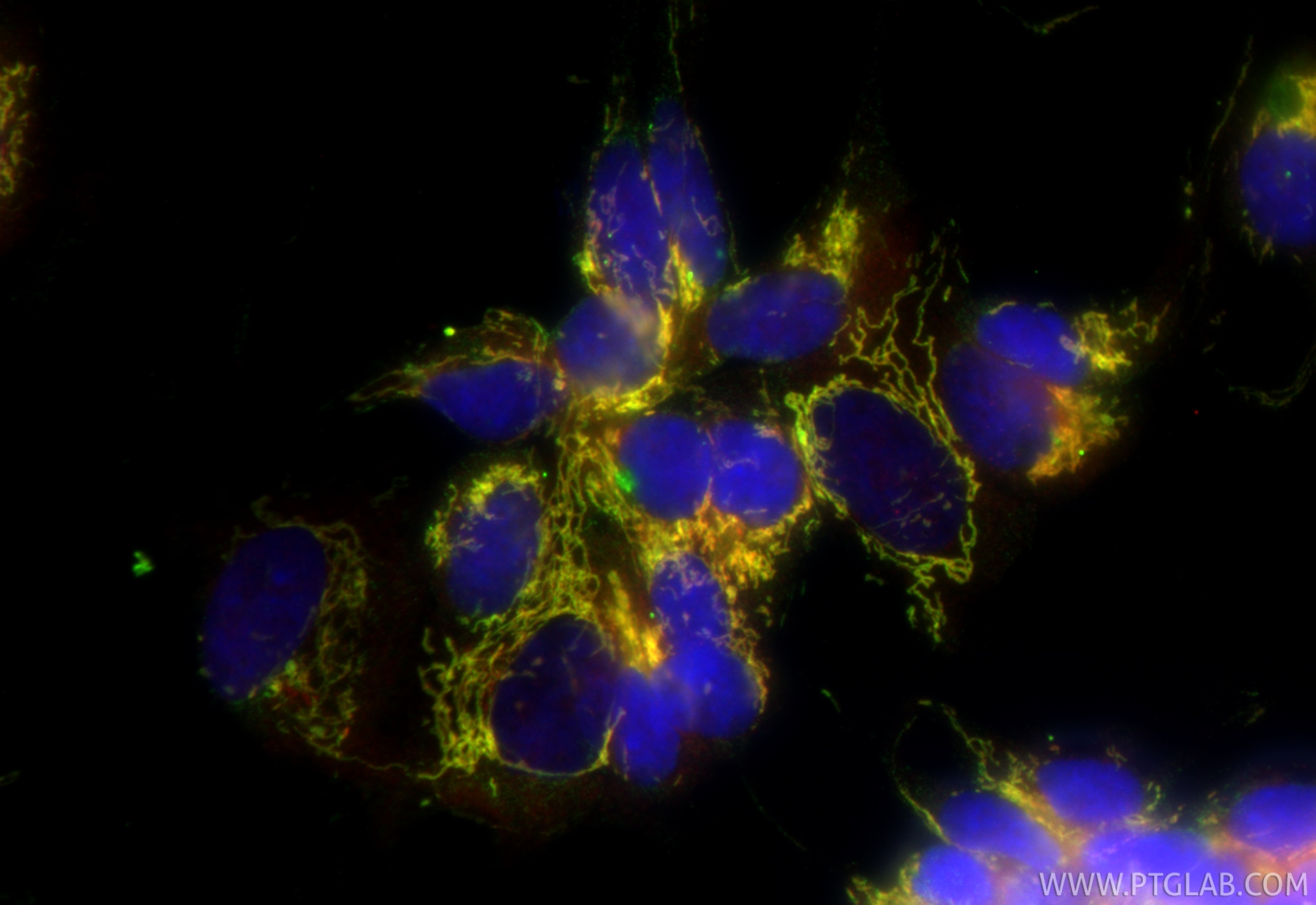 Immunofluorescence (IF) / fluorescent staining of SH-SY5Y cells using ICT1 Polyclonal antibody (10403-1-AP)