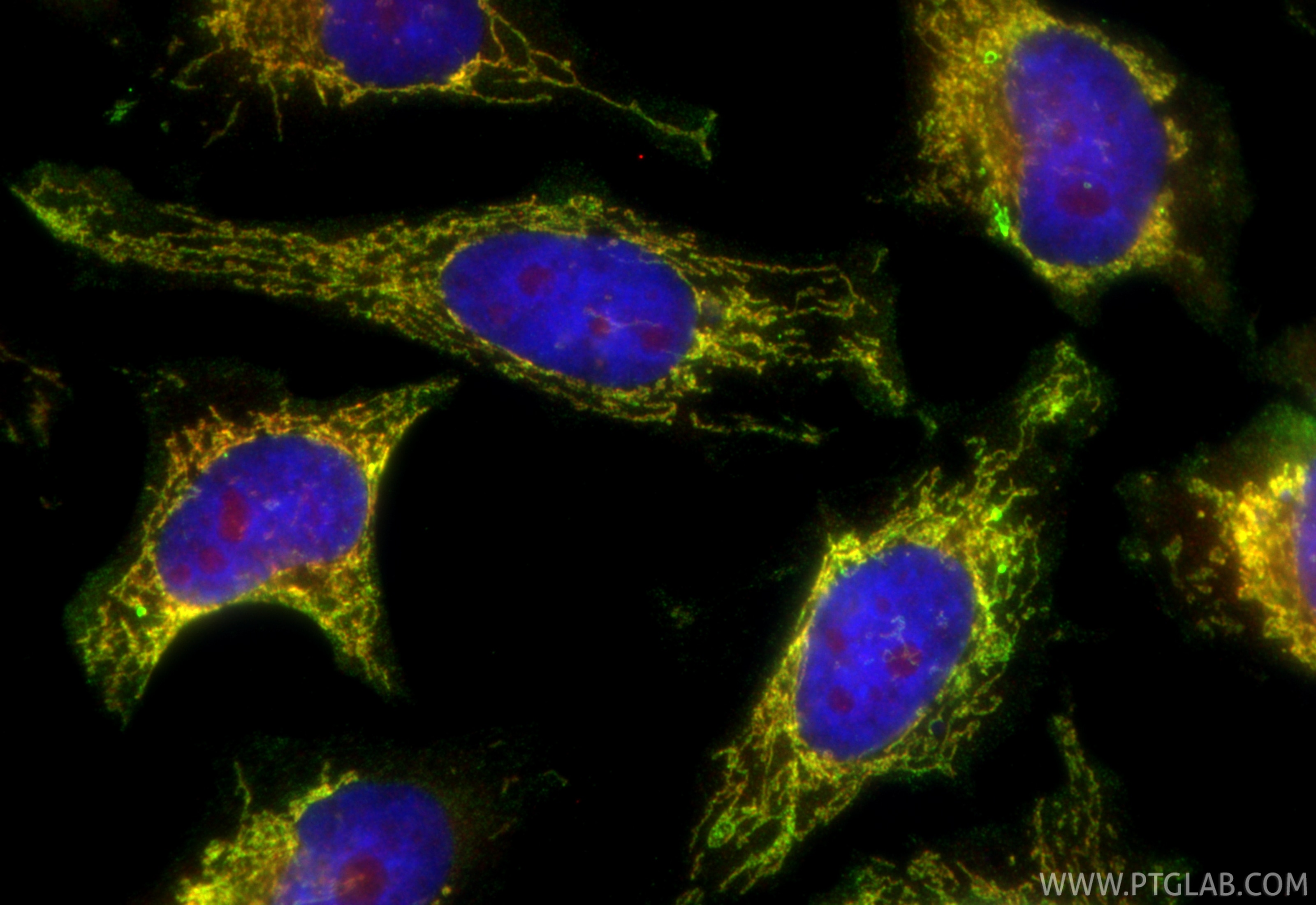 Immunofluorescence (IF) / fluorescent staining of HeLa cells using ICT1 Polyclonal antibody (10403-1-AP)
