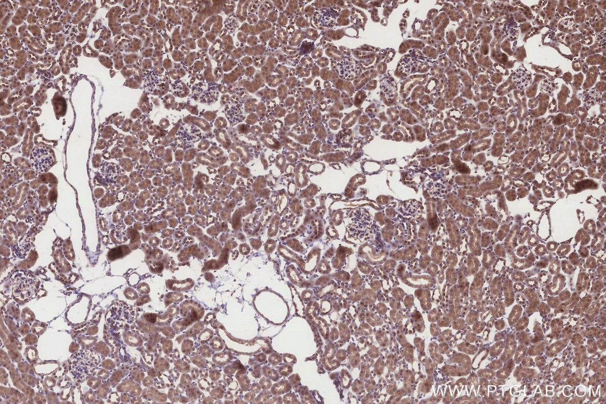 Immunohistochemistry (IHC) staining of mouse kidney tissue using ICT1 Polyclonal antibody (10403-1-AP)
