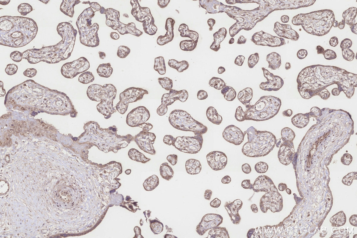 Immunohistochemistry (IHC) staining of human placenta tissue using ICT1 Polyclonal antibody (10403-1-AP)