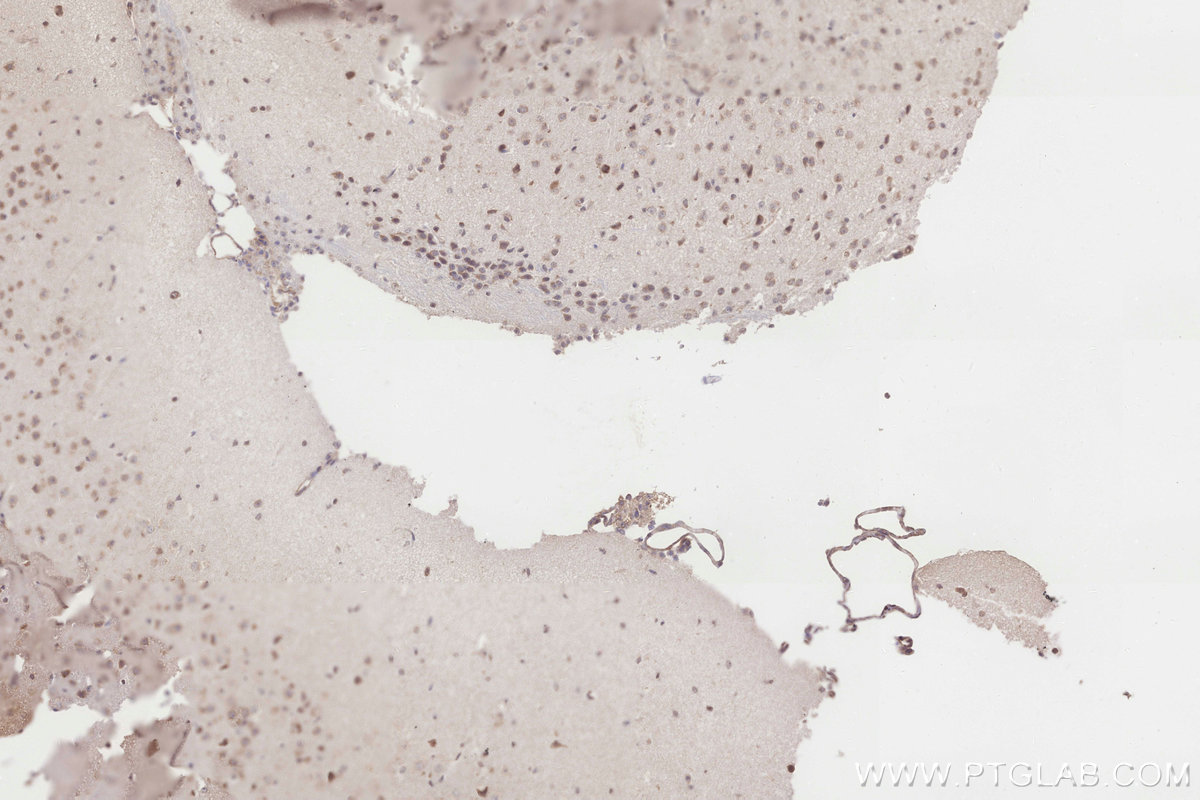 Immunohistochemistry (IHC) staining of mouse brain tissue using ICT1 Polyclonal antibody (10403-1-AP)
