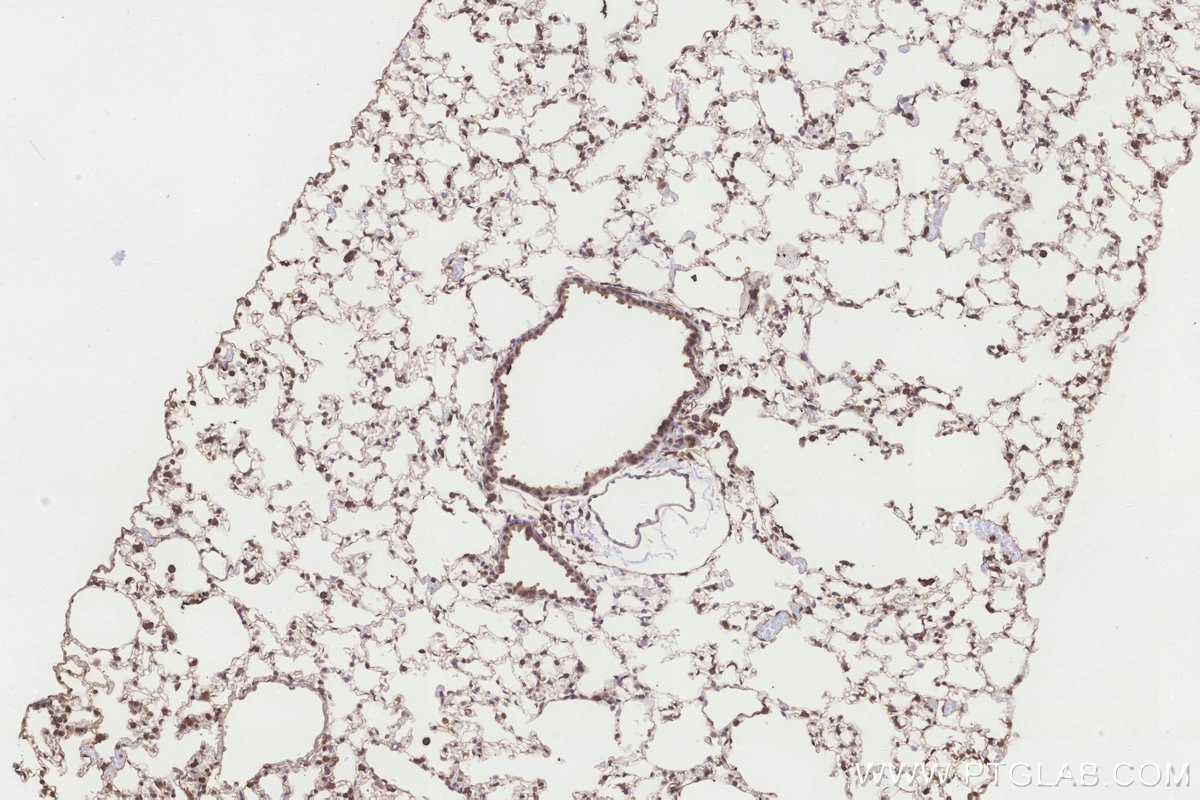 Immunohistochemistry (IHC) staining of mouse lung tissue using ICT1 Polyclonal antibody (10403-1-AP)