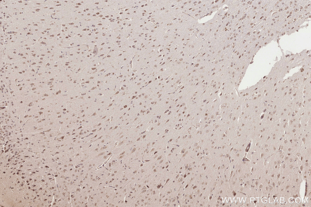 Immunohistochemistry (IHC) staining of rat brain tissue using ICT1 Polyclonal antibody (10403-1-AP)