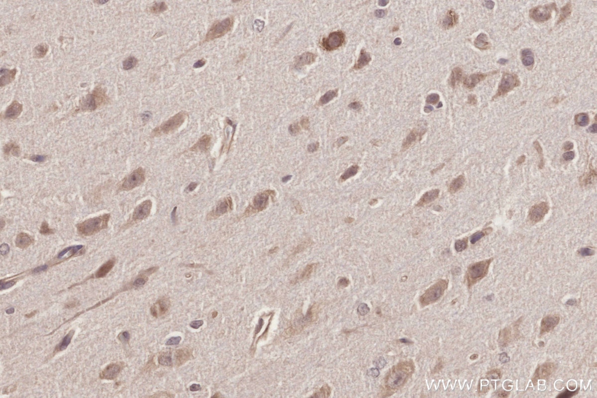 Immunohistochemistry (IHC) staining of rat brain tissue using ICT1 Polyclonal antibody (10403-1-AP)