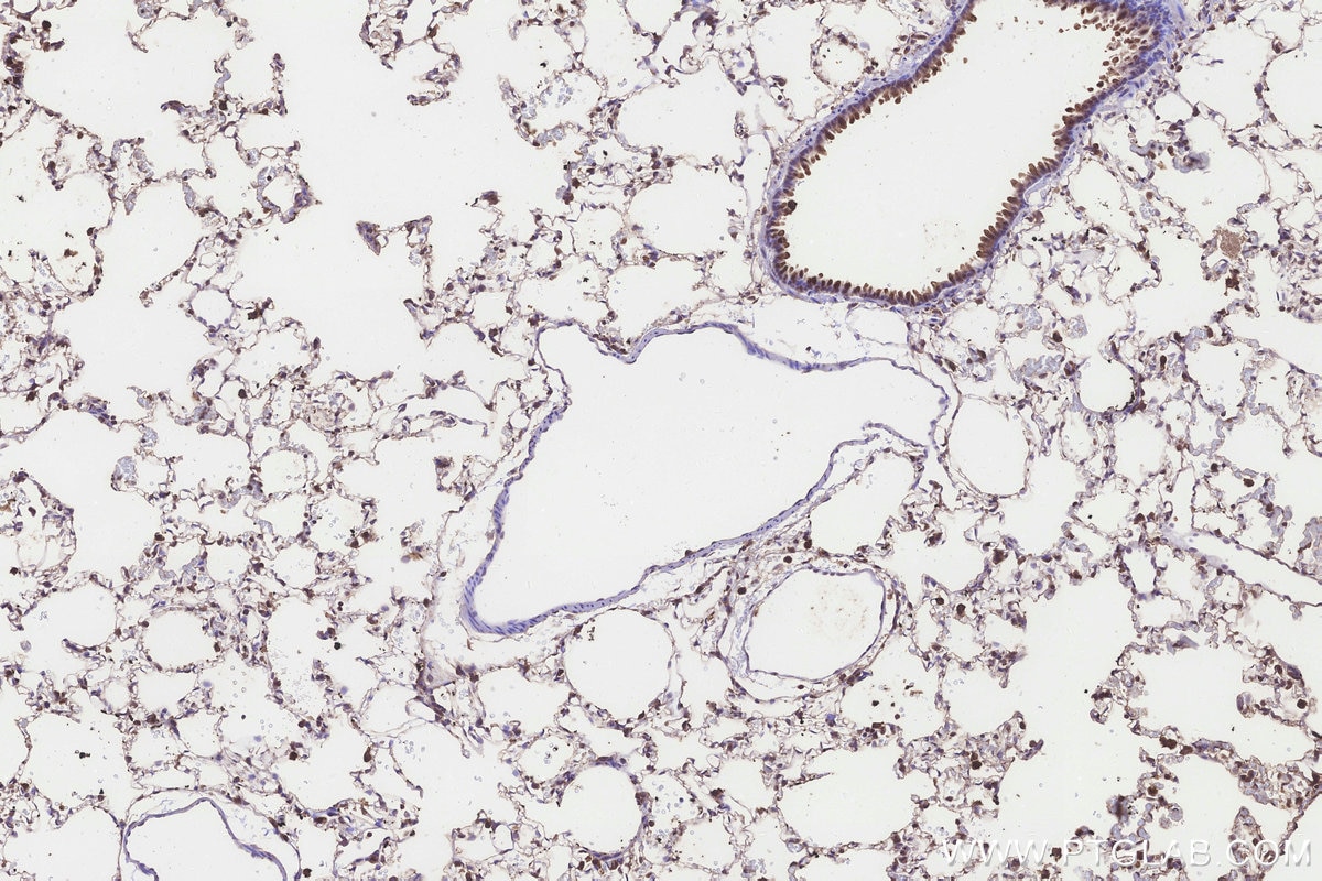 Immunohistochemistry (IHC) staining of rat lung tissue using ICT1 Polyclonal antibody (10403-1-AP)