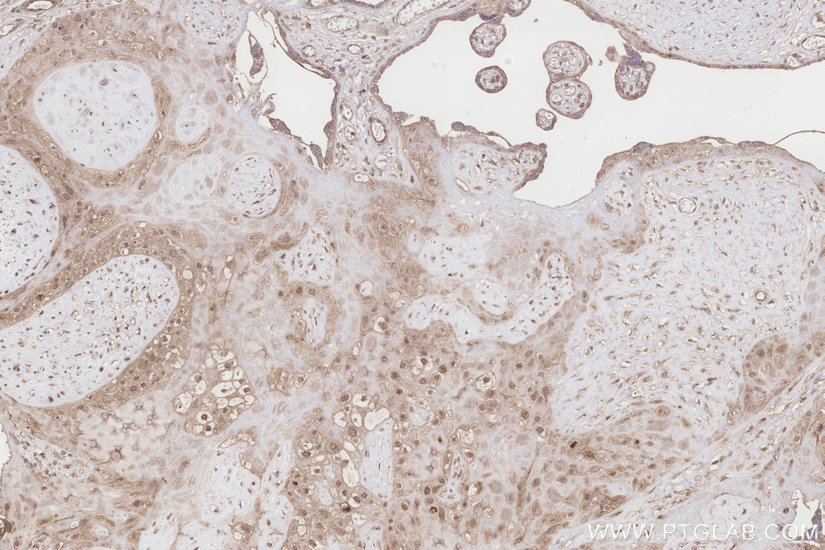 Immunohistochemistry (IHC) staining of human placenta tissue using ICT1 Polyclonal antibody (10403-1-AP)