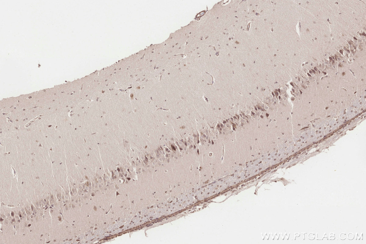 Immunohistochemistry (IHC) staining of rat brain tissue using ICT1 Polyclonal antibody (10403-1-AP)