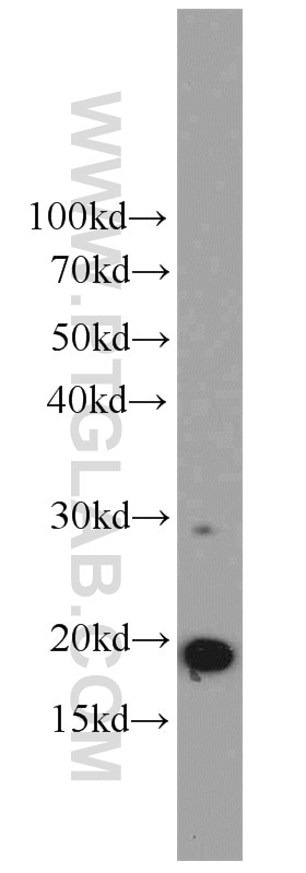 Western Blot (WB) analysis of A2780 cells using ICT1 Polyclonal antibody (10403-1-AP)