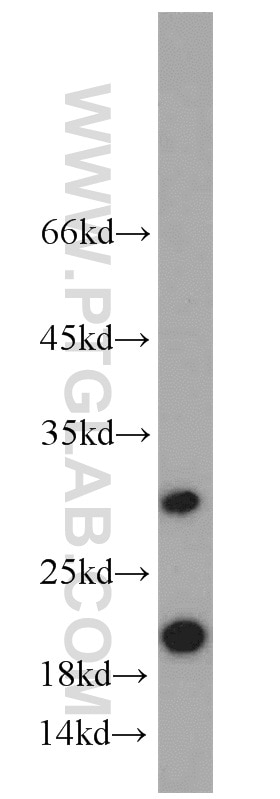 Western Blot (WB) analysis of SKOV-3 cells using ICT1 Polyclonal antibody (10403-1-AP)