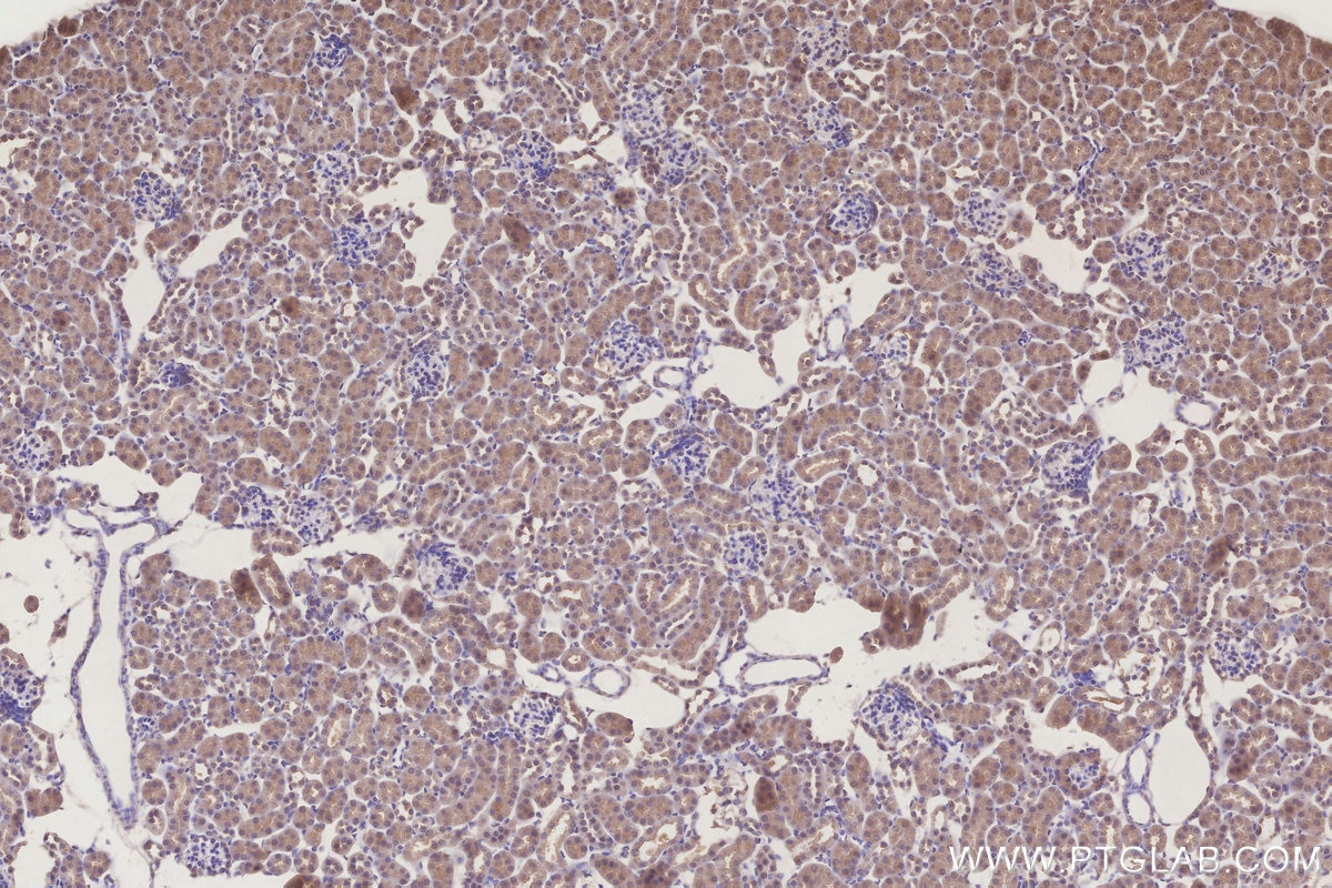 Immunohistochemistry (IHC) staining of mouse kidney tissue using ICT1 Monoclonal antibody (68898-3-Ig)