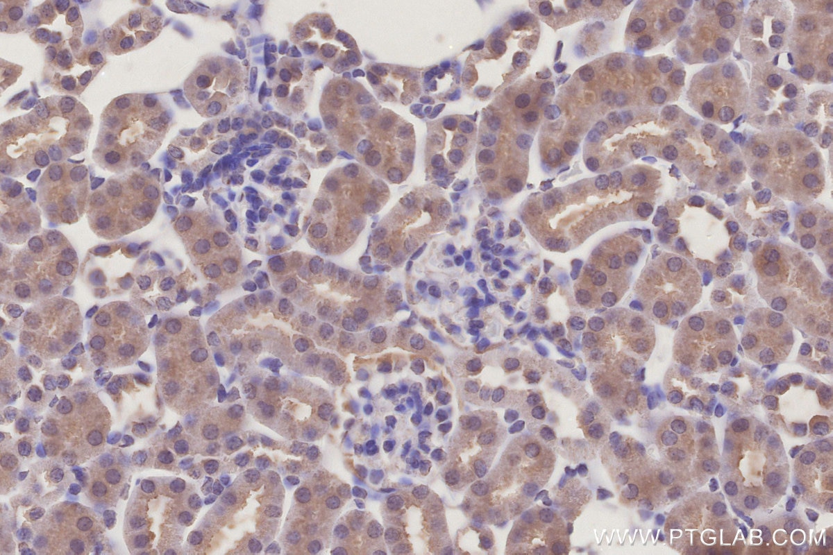 Immunohistochemistry (IHC) staining of mouse kidney tissue using ICT1 Monoclonal antibody (68898-3-Ig)