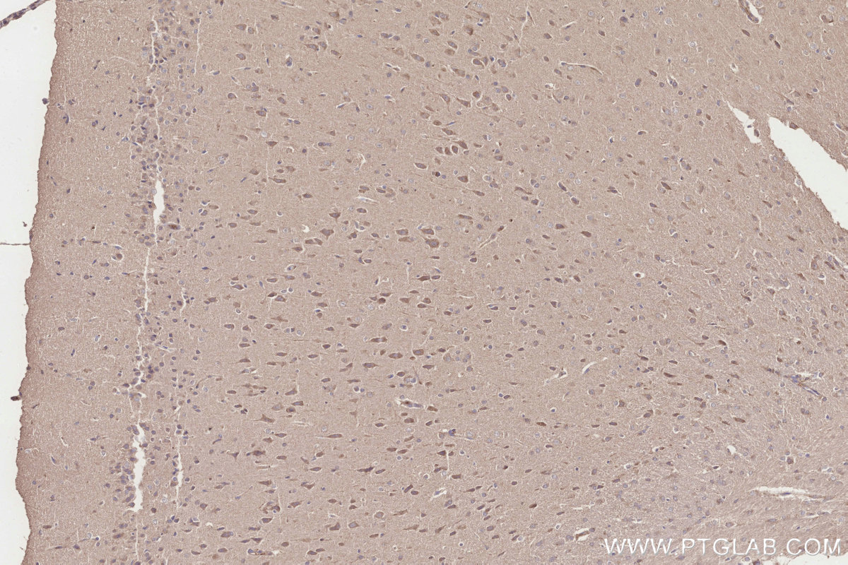 Immunohistochemistry (IHC) staining of rat brain tissue using ICT1 Monoclonal antibody (68898-3-Ig)