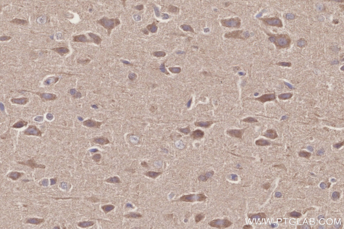 Immunohistochemistry (IHC) staining of rat brain tissue using ICT1 Monoclonal antibody (68898-3-Ig)