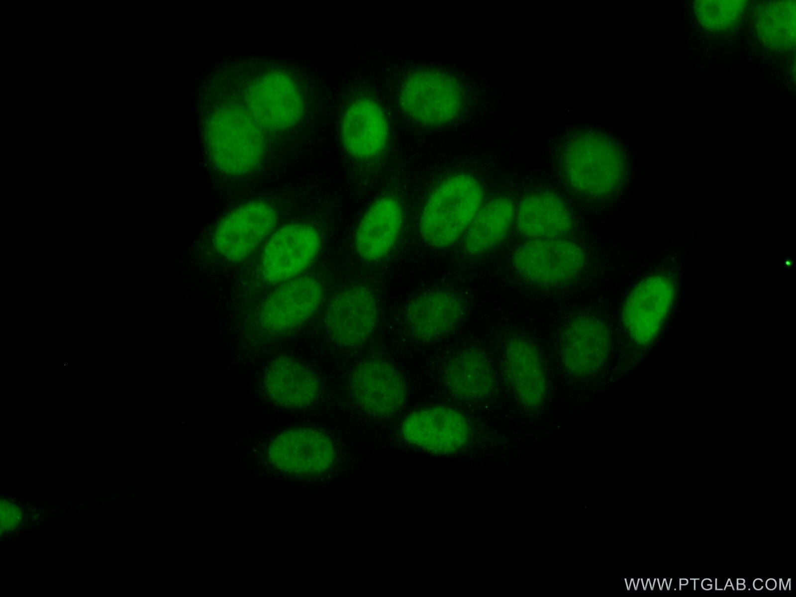 Immunofluorescence (IF) / fluorescent staining of PC-3 cells using ID1 Polyclonal antibody (18475-1-AP)
