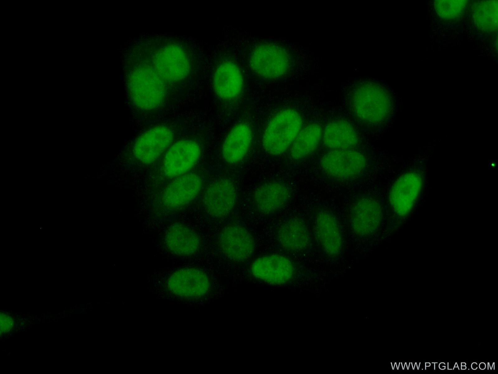 IF Staining of PC-3 using 18475-1-AP