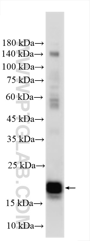 Western Blot (WB) analysis of various lysates using ID1 Polyclonal antibody (18475-1-AP)