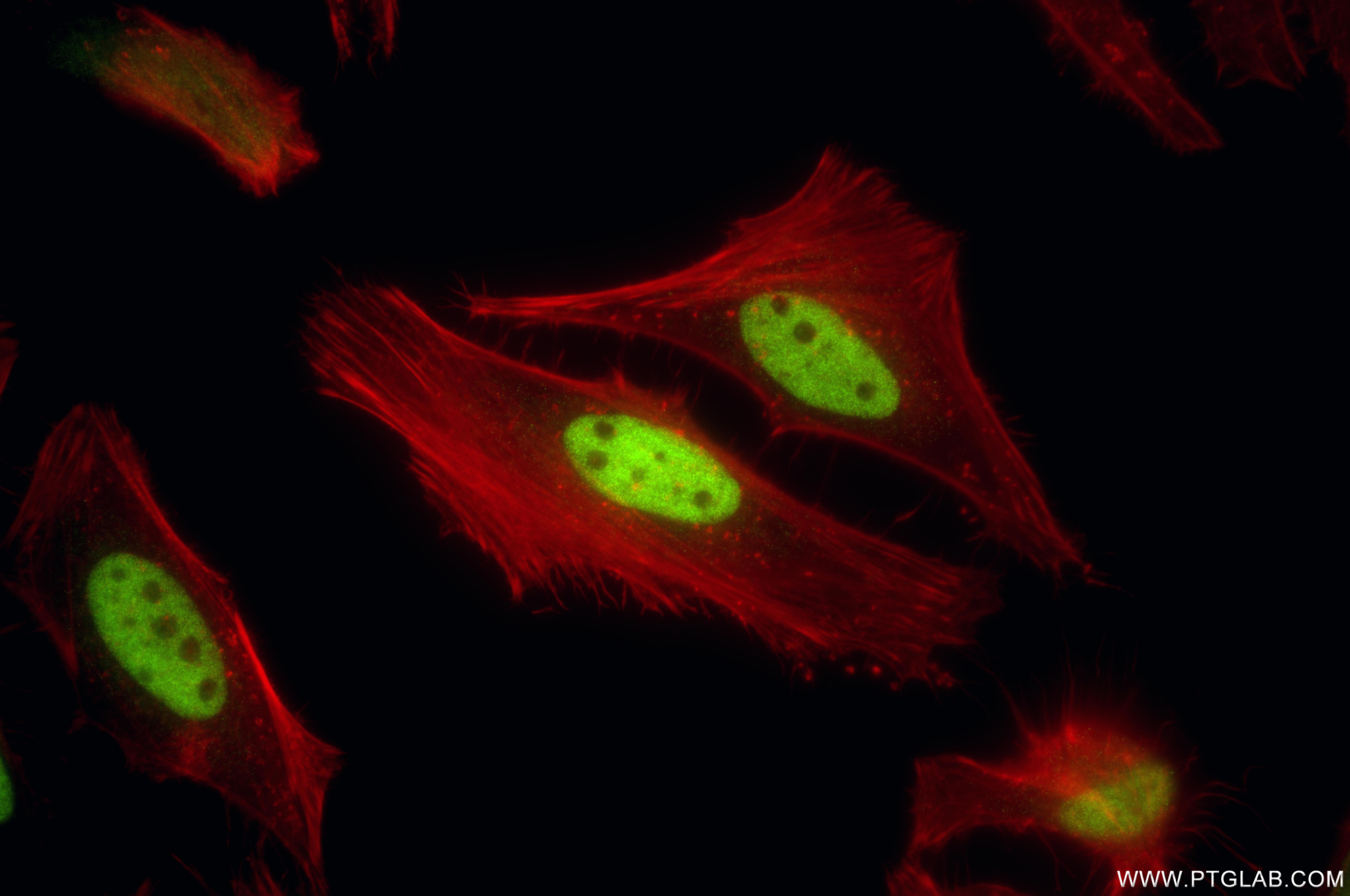 IF Staining of HeLa using 86979-1-RR Immunofluorescence (IF) / fluorescent staining of HeLa cells using ID3 Recombinant monoclonal antibody (86979-1-RR)