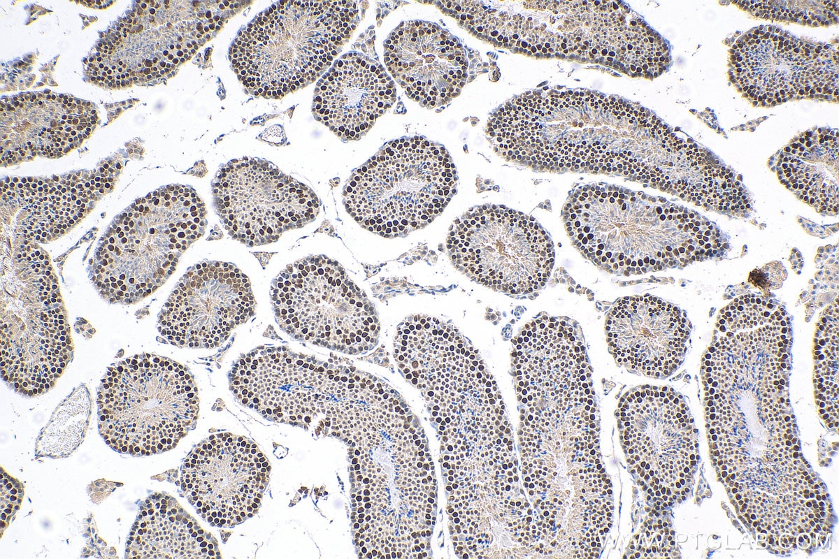 Immunohistochemistry (IHC) staining of mouse testis tissue using ID4 Polyclonal antibody (21803-1-AP)